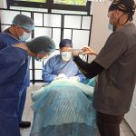 blefaroplastyka górna