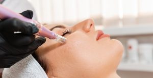 Na czym polega mezoterapia igłowa?