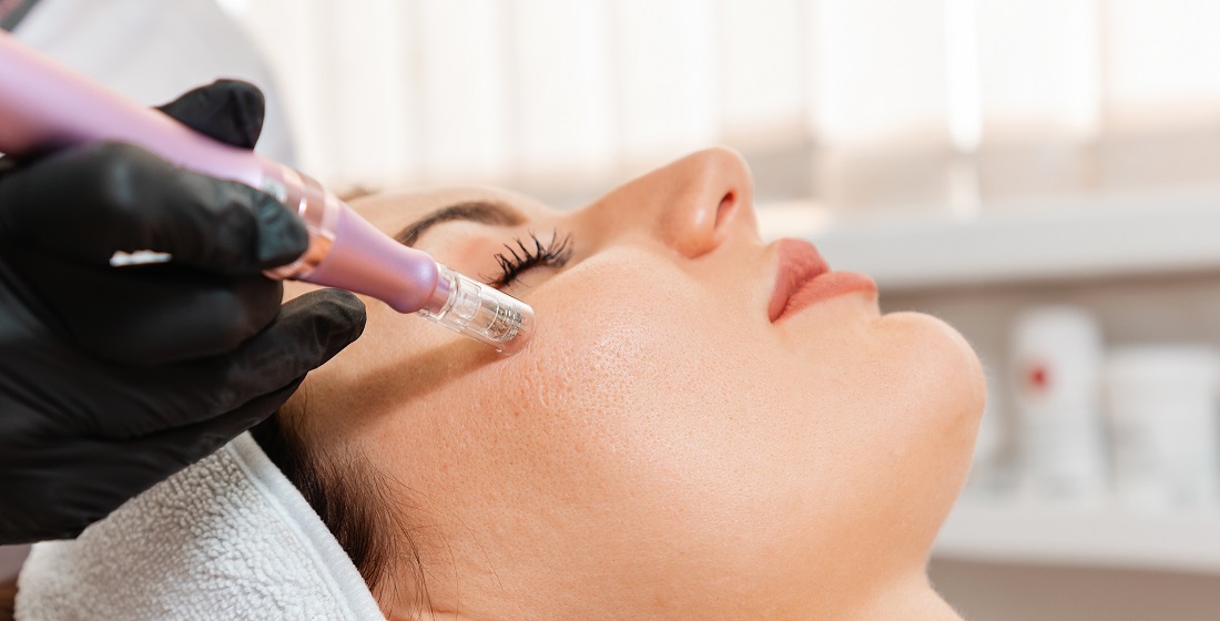 Na czym polega mezoterapia igłowa?